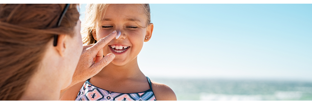 Zonschade-verbrande huid