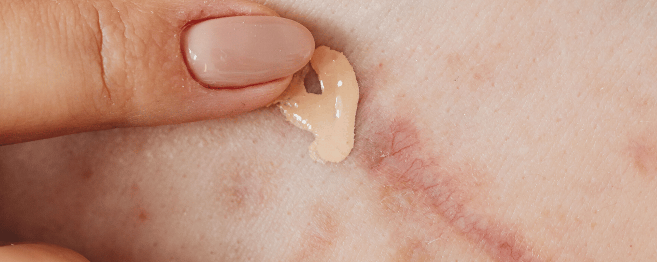 concealer