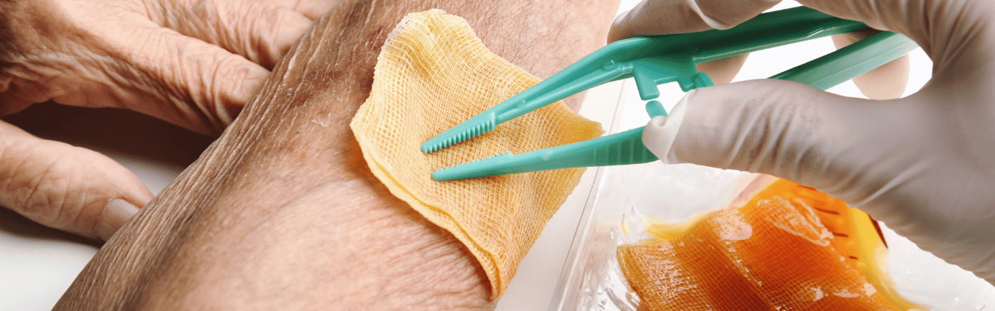 wondverzorging wondverzorging