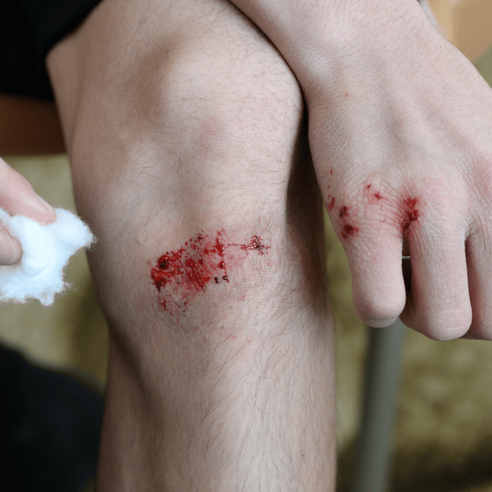 wondverzorging wondverzorging