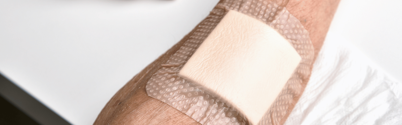 wondverzorging wondverzorging