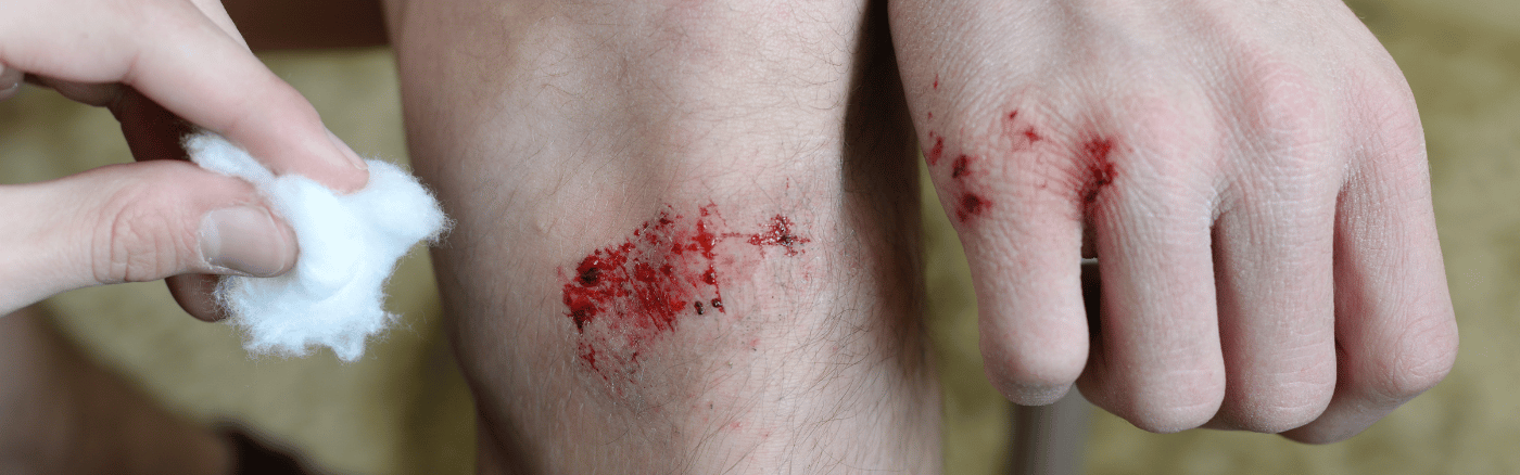 wondverzorging wondverzorging