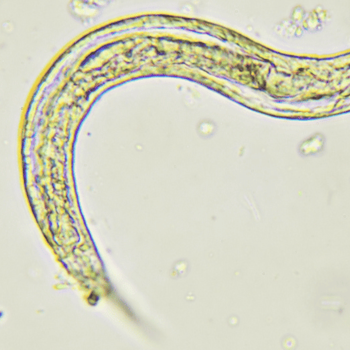 Wormen in ontlasting Snel verhelpen Boots Apotheek Boots Nederland Wormen in ontlasting Snel verhelpen Boots Apotheek Boots Nederland