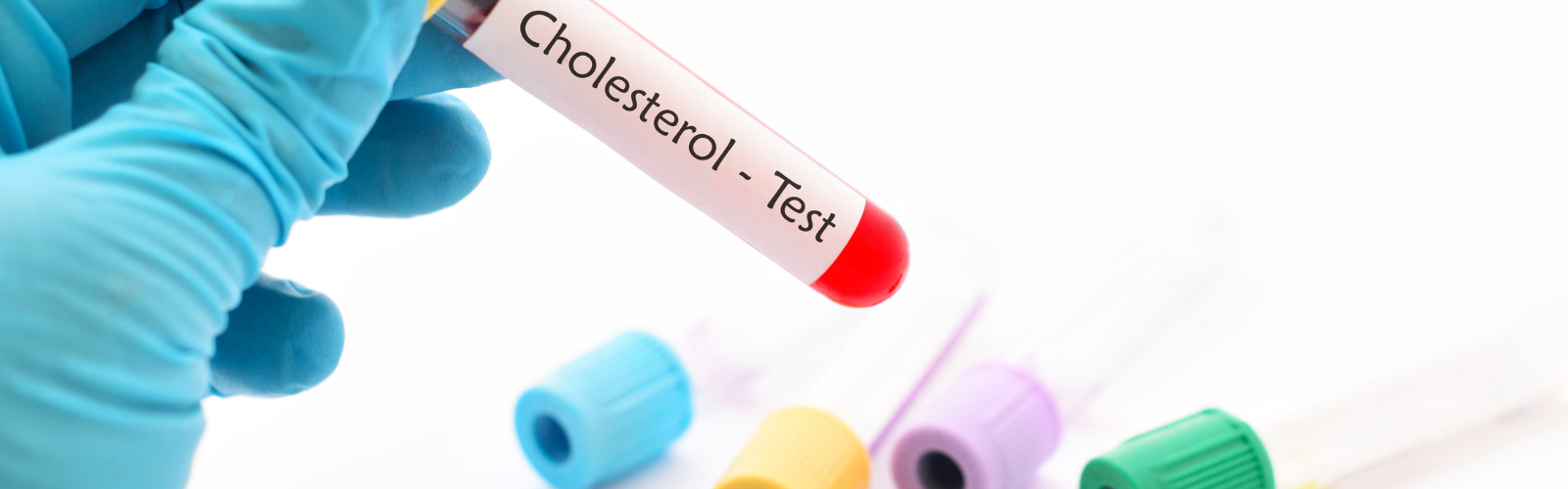 Laat je cholesterolgehalte meten bij Boots apotheek Boots Nederland