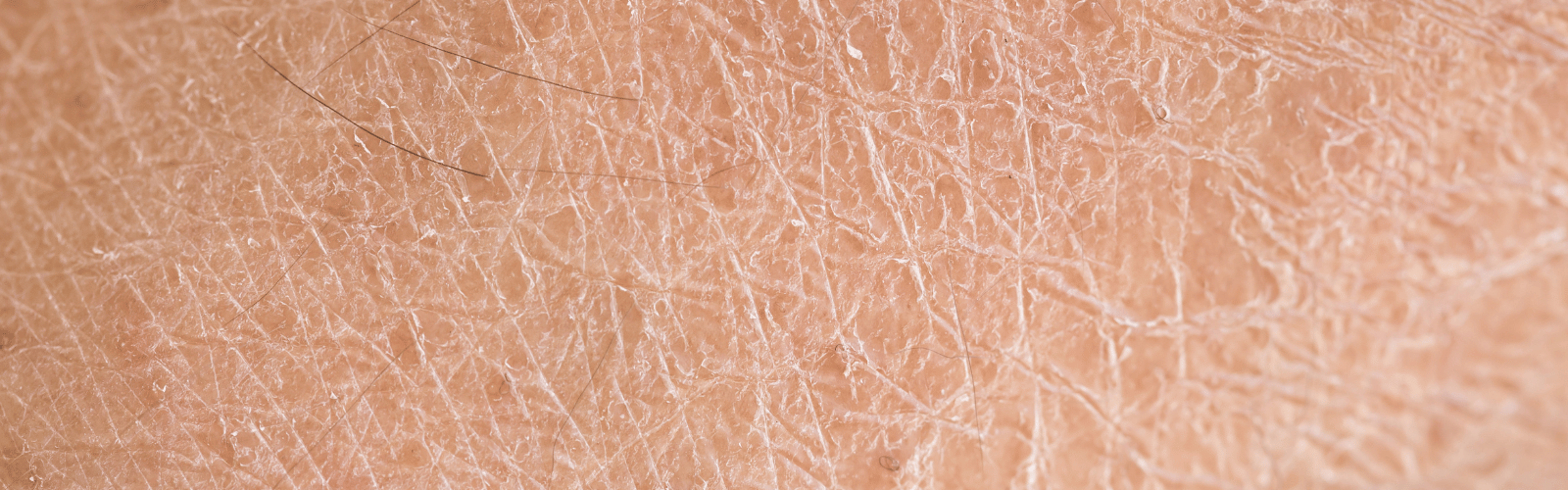 winterjeuk winterjeuk